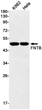FNTB Rabbit mAb